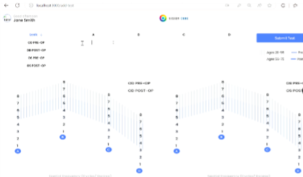 Contrast Sensitivity Chart